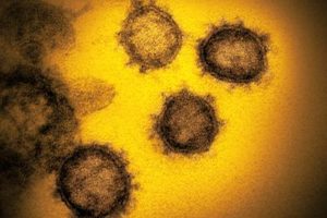 今夏の新型コロナウイルス感染者数再増加は、春先の増加と意味が違う