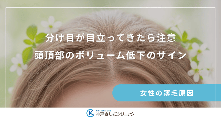 分け目が目立ってきたら注意|頭頂部のボリューム低下のサイン