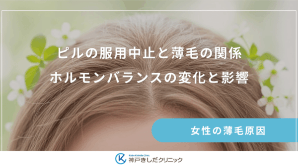 ピルの服用中止と薄毛の関係｜ホルモンバランスの変化と影響
