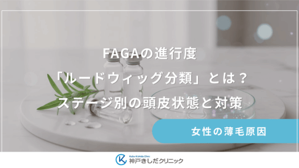 FAGAの進行度「ルードウィッグ分類」とは？ステージ別の頭皮状態と対策
