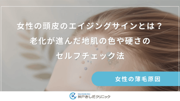 女性の頭皮のエイジングサインとは？老化が進んだ地肌の色や硬さのセルフチェック法
