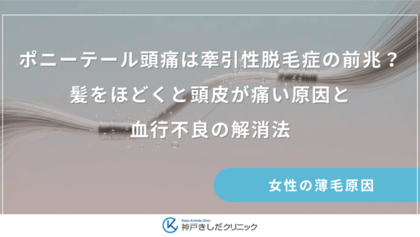 ポニーテール頭痛は牽引性脱毛症の前兆？髪をほどくと頭皮が痛い原因と血行不良の解消法