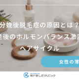 分娩後脱毛症の原因とは？出産後のホルモンバランス激変とヘアサイクル
