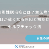 牽引性脱毛症とは？生え際や分け目が薄くなる原因と初期症状のセルフチェック法