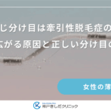 ずっと同じ分け目は牽引性脱毛症のリスク？地肌が広がる原因と正しい分け目の変え方
