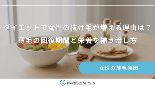 ダイエットで女性の抜け毛が増える理由は？薄毛の回復期間と栄養を補う治し方