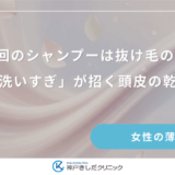 朝晩2回のシャンプーは抜け毛の原因？女性の「洗いすぎ」が招く頭皮の乾燥と薄毛
