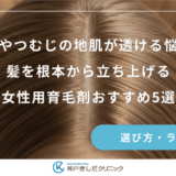 頭頂部やつむじの地肌が透ける悩みに！髪を根本から立ち上げる女性用育毛剤おすすめ5選