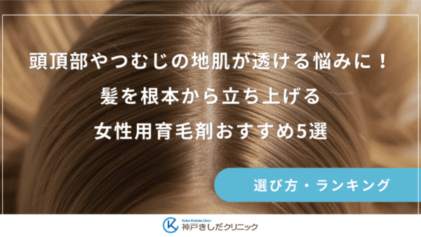 頭頂部やつむじの地肌が透ける悩みに！髪を根本から立ち上げる女性用育毛剤おすすめ5選