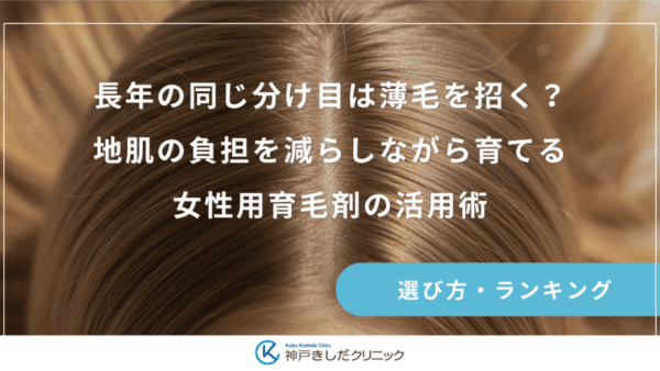 長年の同じ分け目は薄毛を招く？地肌の負担を減らしながら育てる女性用育毛剤の活用術