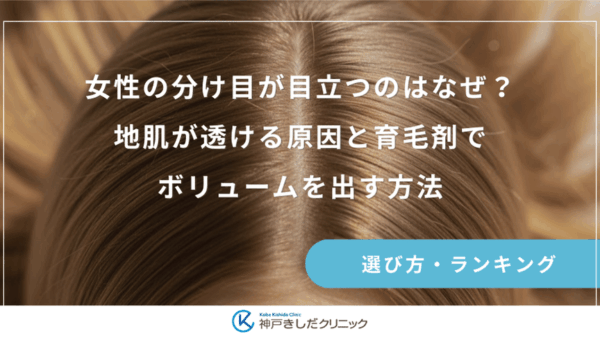 女性の分け目が目立つのはなぜ？地肌が透ける原因と育毛剤でボリュームを出す方法