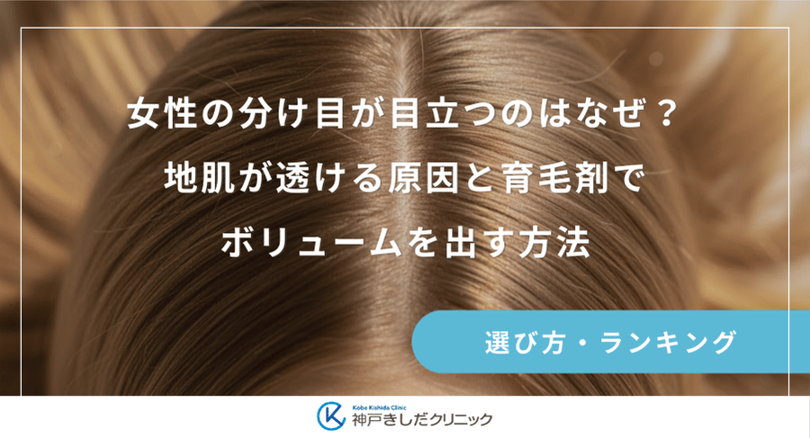 女性の分け目が目立つのはなぜ？地肌が透ける原因と育毛剤でボリュームを出す方法