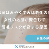 頭皮の黄ばみやくすみは老化の証拠？女性の地肌が変色して薄毛リスクが高まる原因