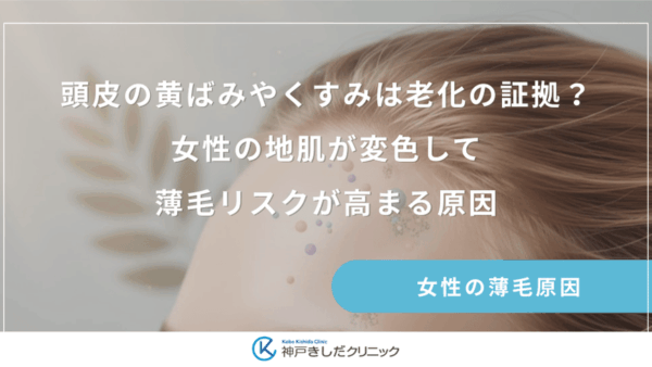 頭皮の黄ばみやくすみは老化の証拠？女性の地肌が変色して薄毛リスクが高まる原因