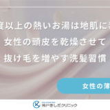 40度以上の熱いお湯は地肌に毒？女性の頭皮を乾燥させて抜け毛を増やす洗髪習慣