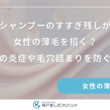 シャンプーのすすぎ残しが女性の薄毛を招く？頭皮の炎症や毛穴詰まりを防ぐ対策