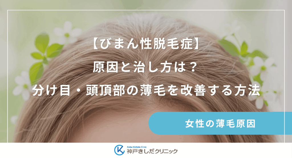 【びまん性脱毛症】原因と治し方は？女性の分け目・頭頂部の薄毛を改善する方法