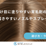 女性の分け目に塗りやすい育毛剤の形状は？地肌に届きやすいノズルやスプレーの比較
