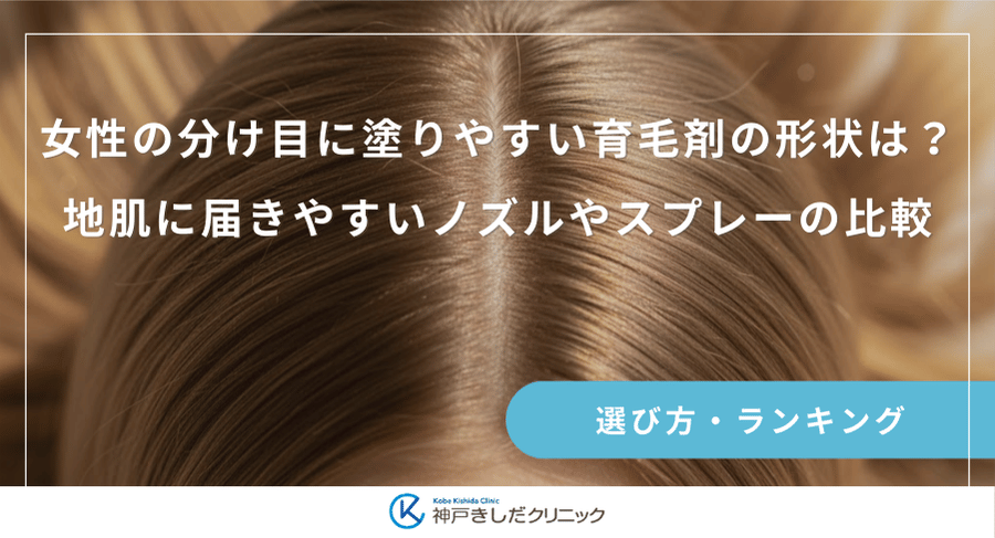 女性の分け目に塗りやすい育毛剤の形状は?地肌に届きやすいノズルやスプレーの比較