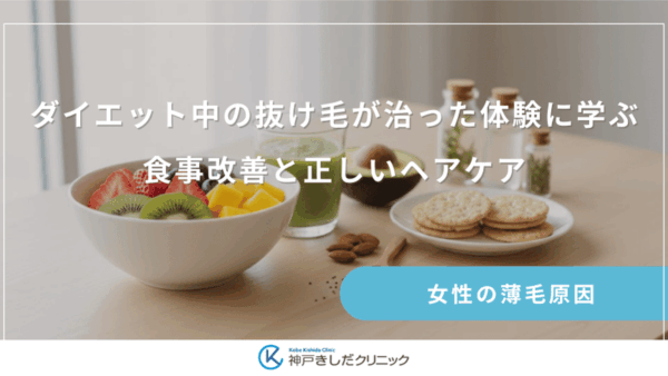 ダイエット中の抜け毛が治った体験に学ぶ｜食事改善と正しいヘアケア