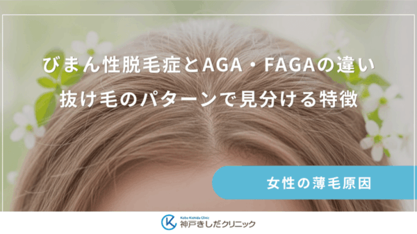 びまん性脱毛症とAGA・FAGAの違い｜抜け毛のパターンで見分ける特徴