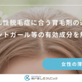 びまん性脱毛症に合う育毛剤の選び方｜パントガール等の有効成分を解説
