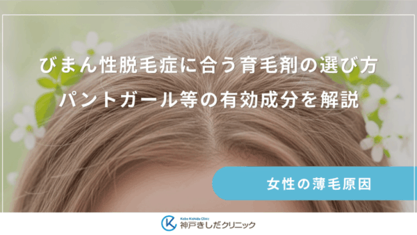 びまん性脱毛症に合う育毛剤の選び方｜パントガール等の有効成分を解説