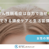 びまん性脱毛症は自力で治せる？自宅でできる頭皮ケアと生活習慣の改善