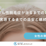 びまん性脱毛症が治るまでの期間｜発毛を実感するまでの目安と継続のコツ