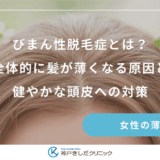 びまん性脱毛症とは？全体的に髪が薄くなる原因と健やかな頭皮への対策