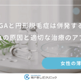 FAGAと円形脱毛症は併発する？それぞれの原因と適切な治療のアプローチ