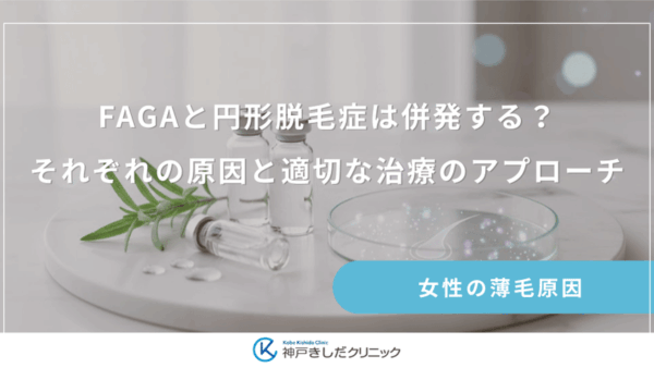 FAGAと円形脱毛症は併発する？それぞれの原因と適切な治療のアプローチ