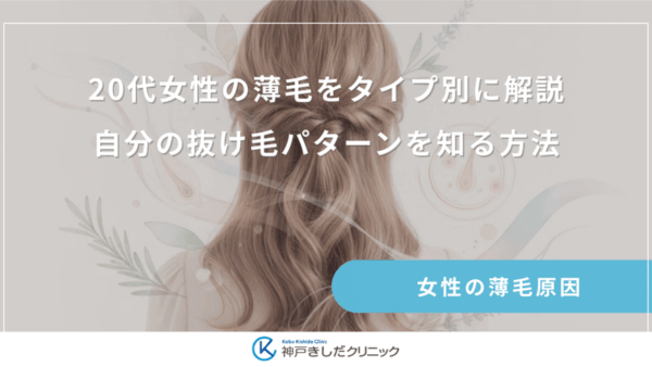 20代女性の薄毛をタイプ別に解説｜自分の抜け毛パターンを知る方法