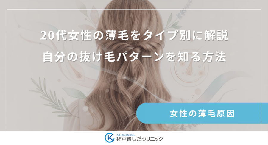 20代女性の薄毛をタイプ別に解説｜自分の抜け毛パターンを知る方法
