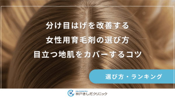 分け目はげを改善する女性用育毛剤の選び方｜目立つ地肌をカバーするコツ