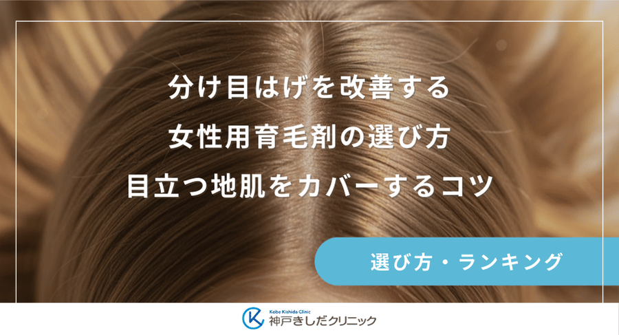 分け目はげを改善する女性用育毛剤の選び方｜目立つ地肌をカバーするコツ