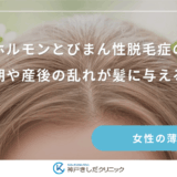 女性ホルモンとびまん性脱毛症の関係｜更年期や産後の乱れが髪に与える影響