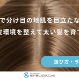 育毛剤で分け目の地肌を目立たなくする｜頭皮環境を整えて太い髪を育てる