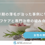 更年期の薄毛が治った事例に学ぶ｜セルフケアと専門治療の組み合わせ