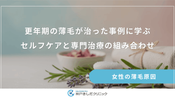 更年期の薄毛が治った事例に学ぶ｜セルフケアと専門治療の組み合わせ