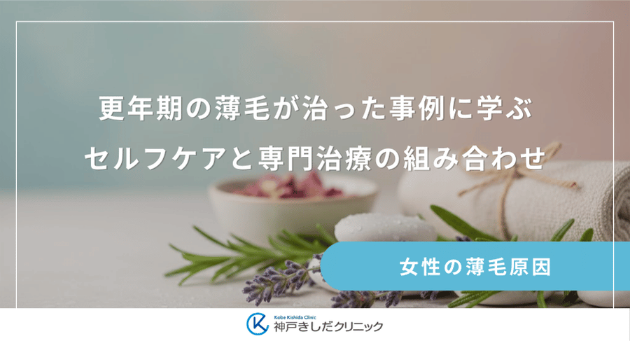 更年期の薄毛が治った事例に学ぶ｜セルフケアと専門治療の組み合わせ