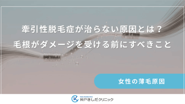 牽引性脱毛症が治らない原因とは？毛根がダメージを受ける前にすべきこと