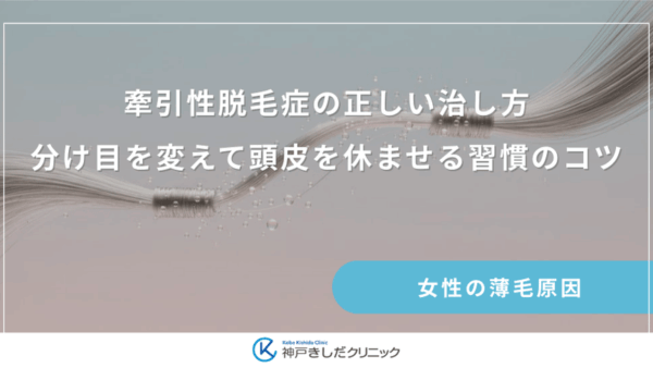 牽引性脱毛症の正しい治し方｜分け目を変えて頭皮を休ませる習慣のコツ