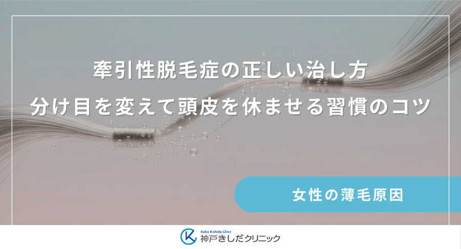 牽引性脱毛症の正しい治し方|分け目を変えて頭皮を休ませる習慣のコツ