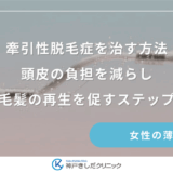 牽引性脱毛症を治す方法｜頭皮の負担を減らし毛髪の再生を促すステップ