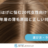 分け目はげに悩む20代女性向け育毛剤｜若年層の薄毛原因と正しい対策