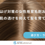 分け目はげ対策の女性用育毛剤おすすめ｜地肌の透けを抑えて髪を育てる