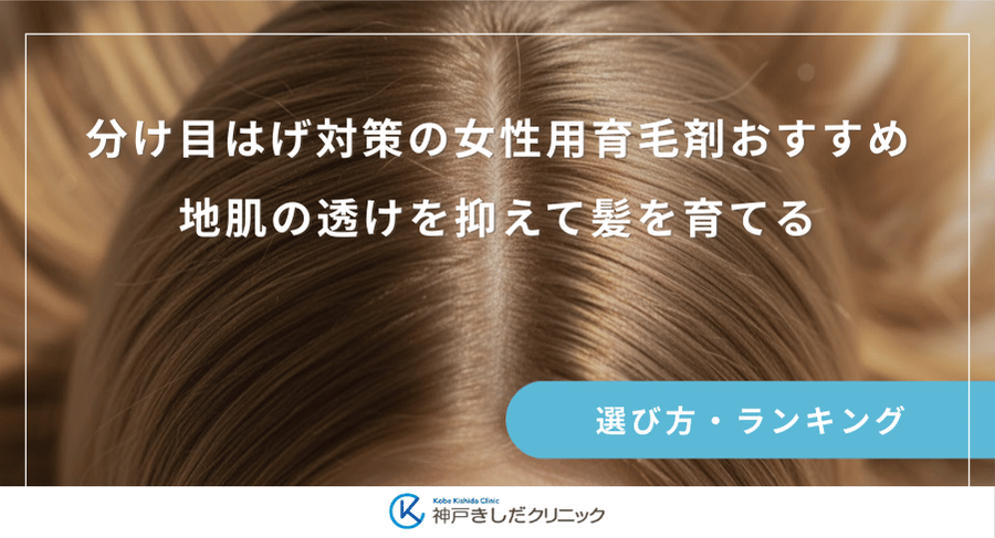 分け目はげ対策の女性用育毛剤おすすめ｜地肌の透けを抑えて髪を育てる