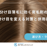 女性の分け目薄毛に効く育毛剤の選び方｜分け目を変える対策と併用術