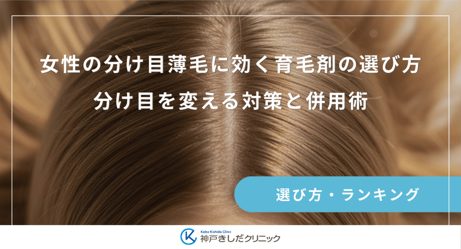 女性の分け目薄毛に効く育毛剤の選び方｜分け目を変える対策と併用術